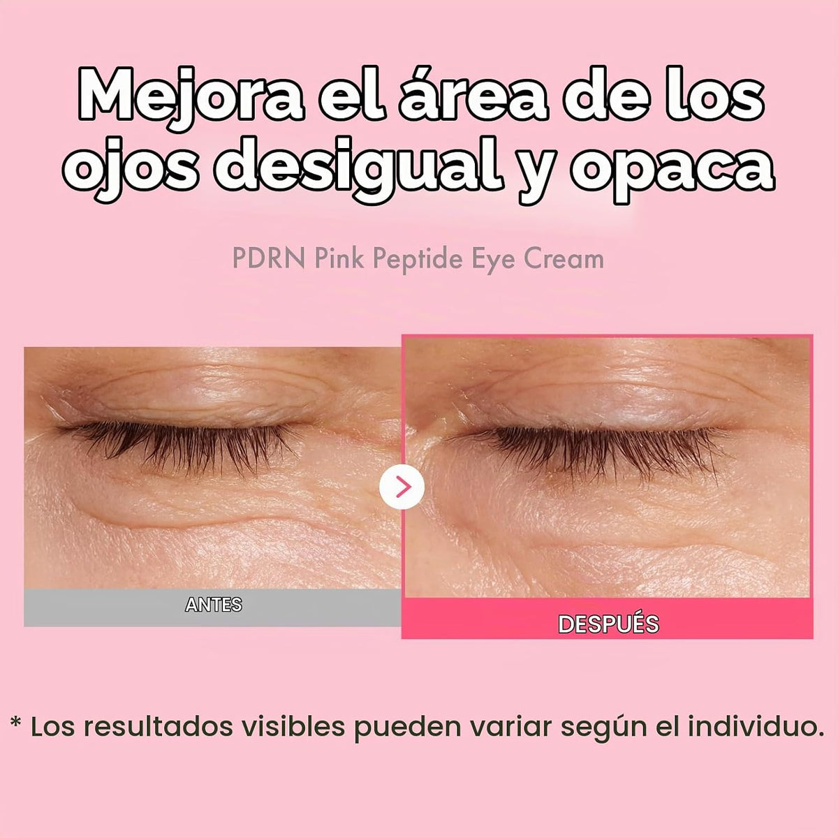 TOSOWOONG K-Beauty Kit de piel de vidrio de 3 pasos, suero de 12 pé...
