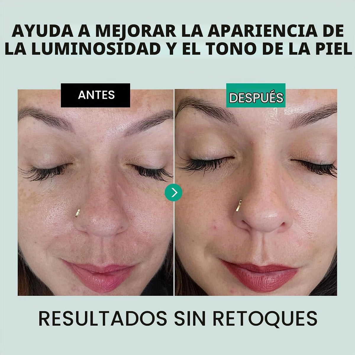 Eclat Skincare Suero de niacinamida clarificante, 12% niacinamida c...