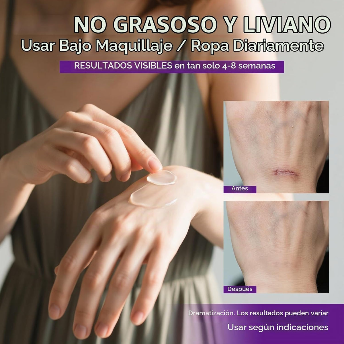 Gel de cicatriz avanzado | Cicatrices de acné y quemaduras, cicatri...