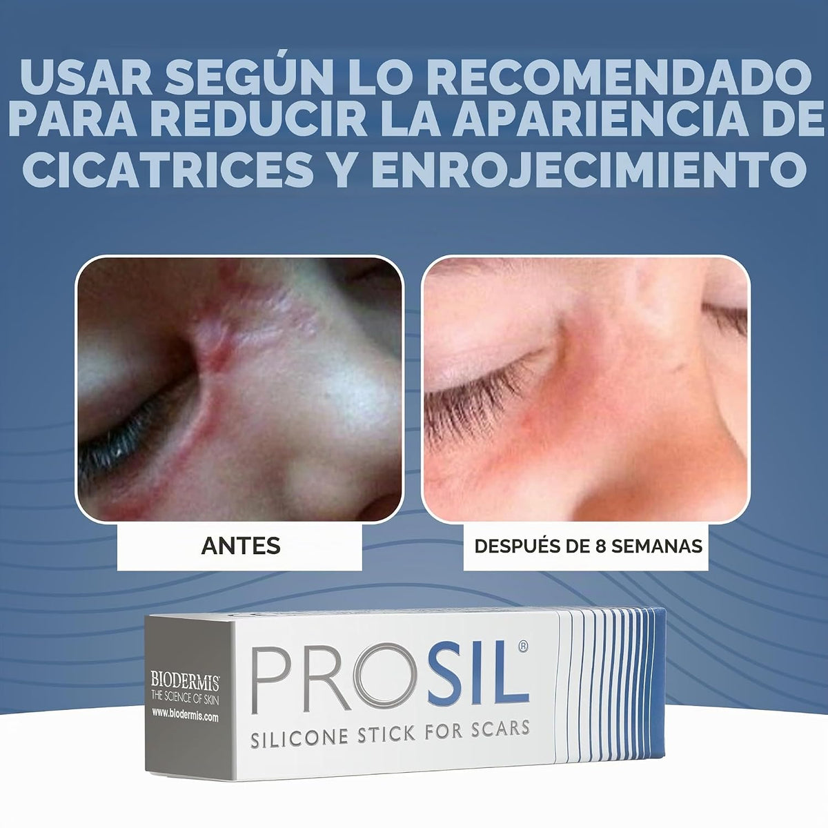Biodermis Pro-SIL - Barra de gel de silicona para cicatrices, cuida...