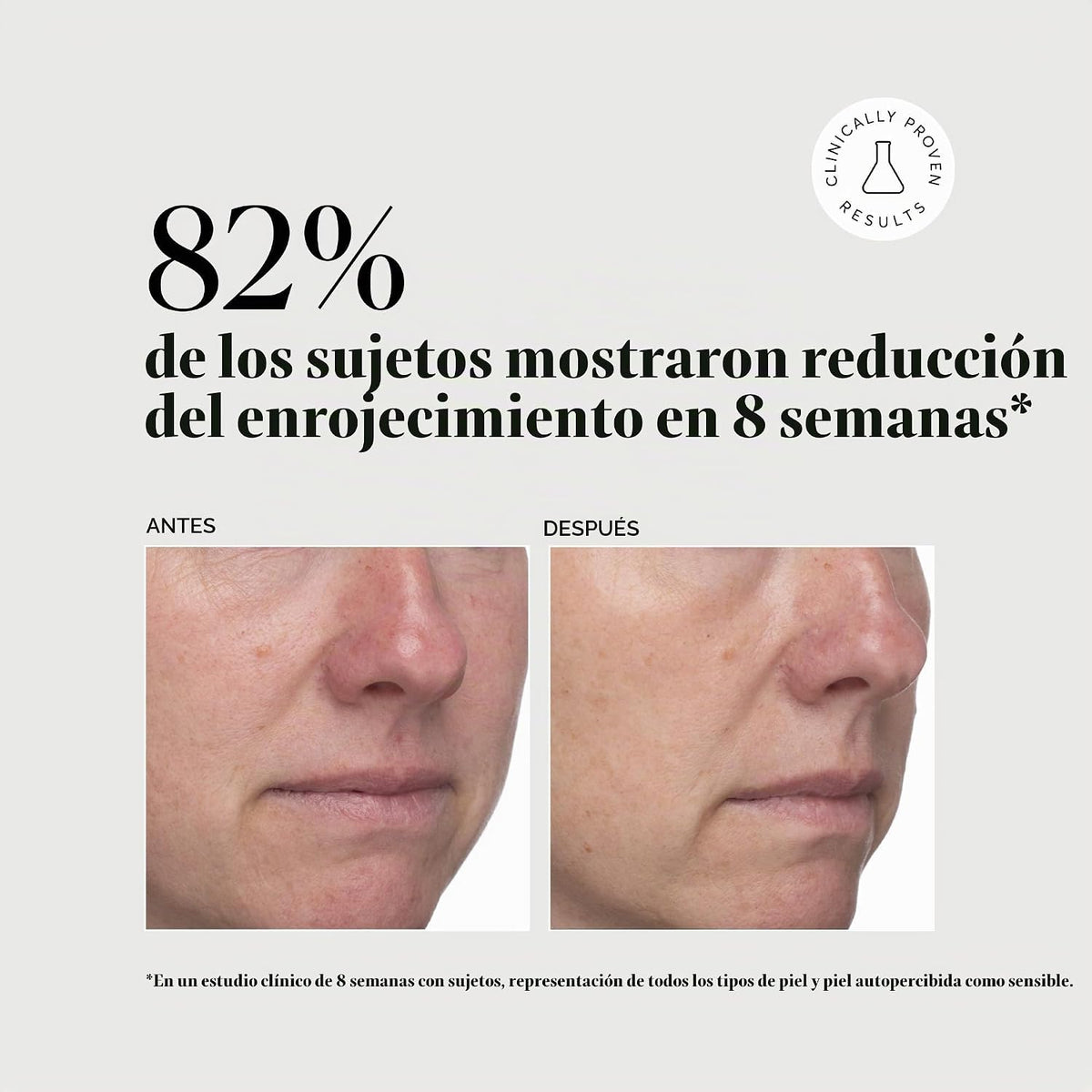Naturium Ácido Azelaico Tópico 10%, tratamiento de belleza para el...