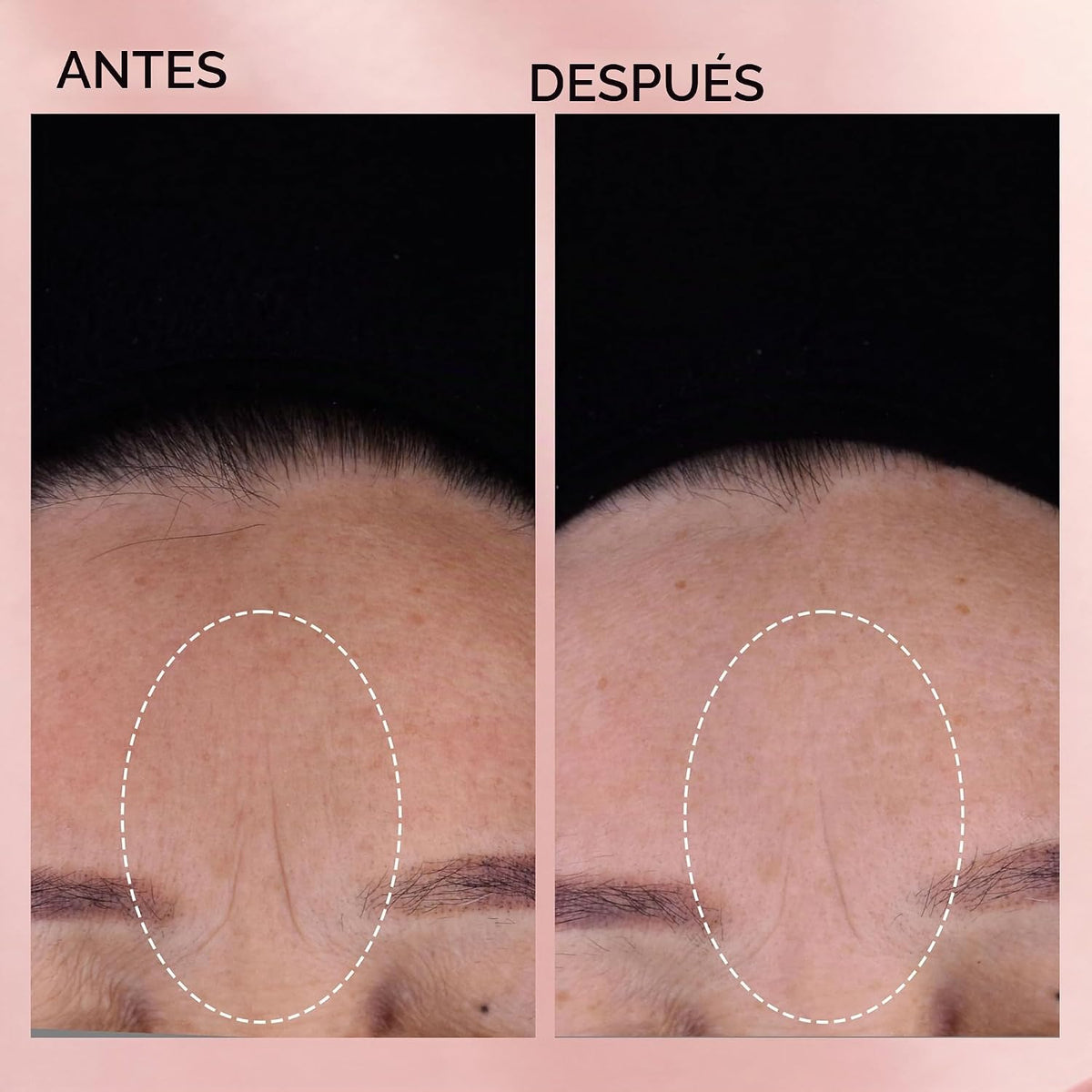 Cápsulas de suero facial de retinol + HPR de ceramidas de Elizabeth...