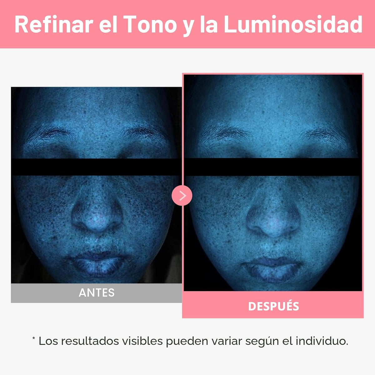 TOSOWOONG K-Beauty Kit de piel de vidrio de 3 pasos, suero de 12 pé...