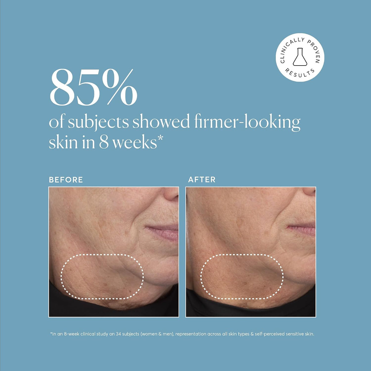 Naturium Retinol Complex Serum, retinoles encapsulados y bakuchiol,...
