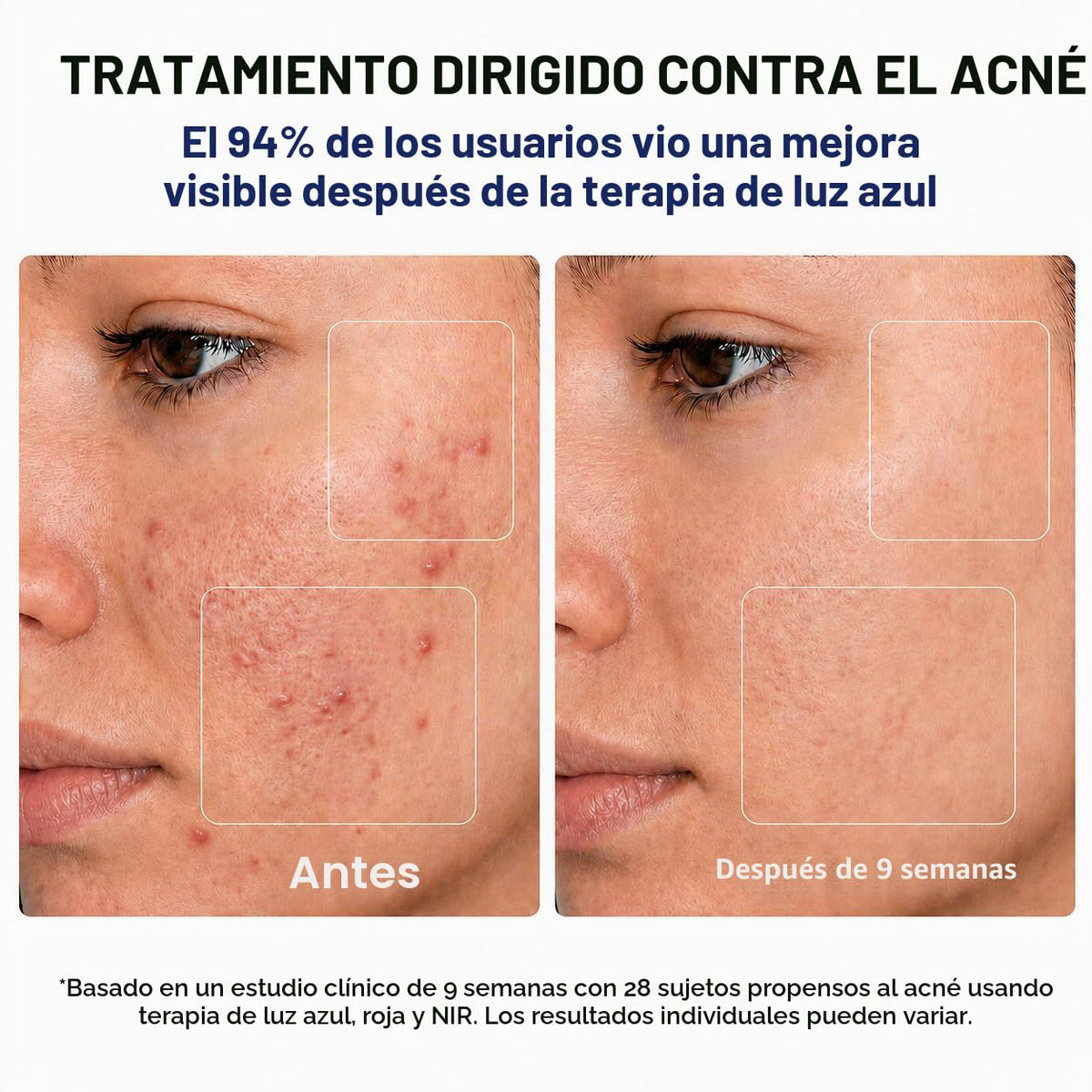 MICEYLIVE Terapia de luz roja para máscara facial, terapia de luz a...