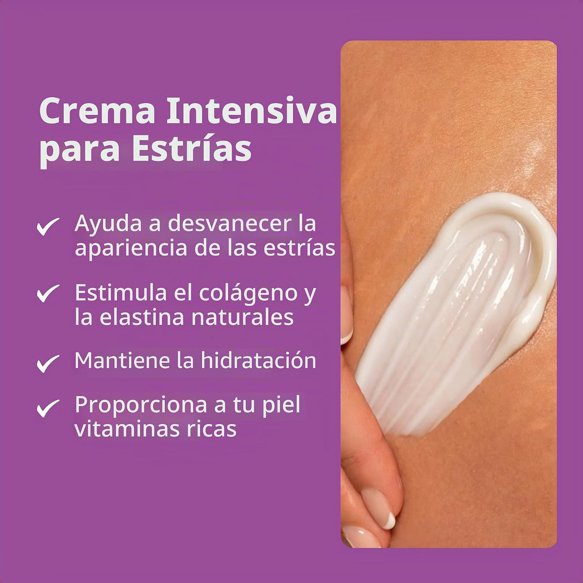 Crema para las estrías TriLASTIN-SR potente para reducir estrías pr...