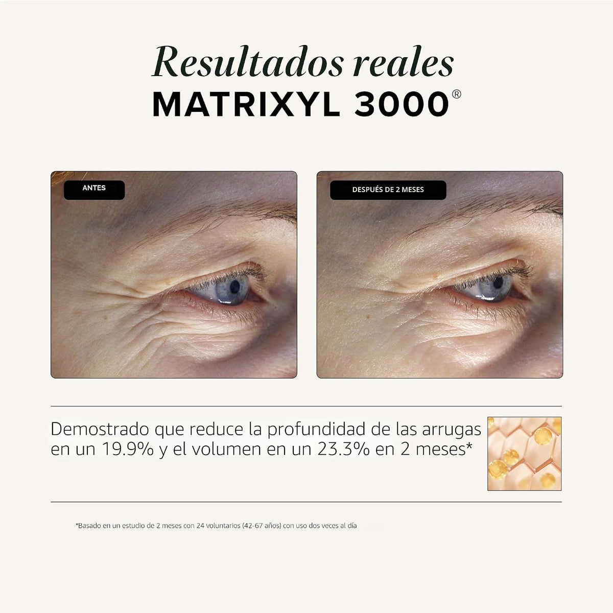 Suero peptídico triple reparación Asterwood, Matrixyl 3000, Argirel...