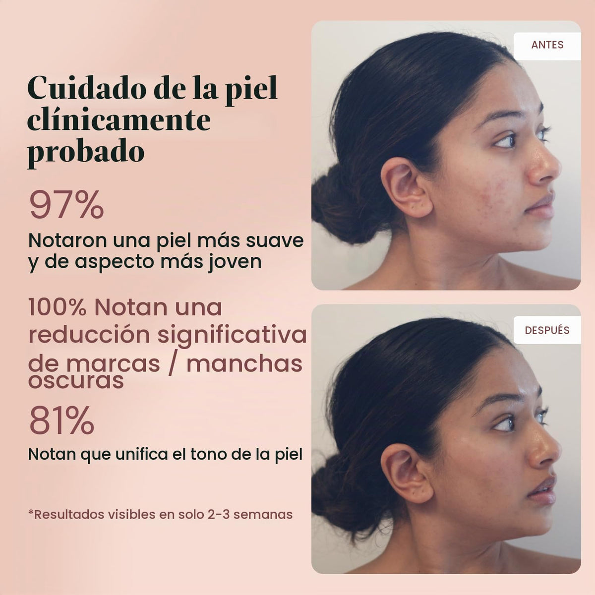 ADM - Suero de retinol puro antienvejecimiento para cara con niacin...