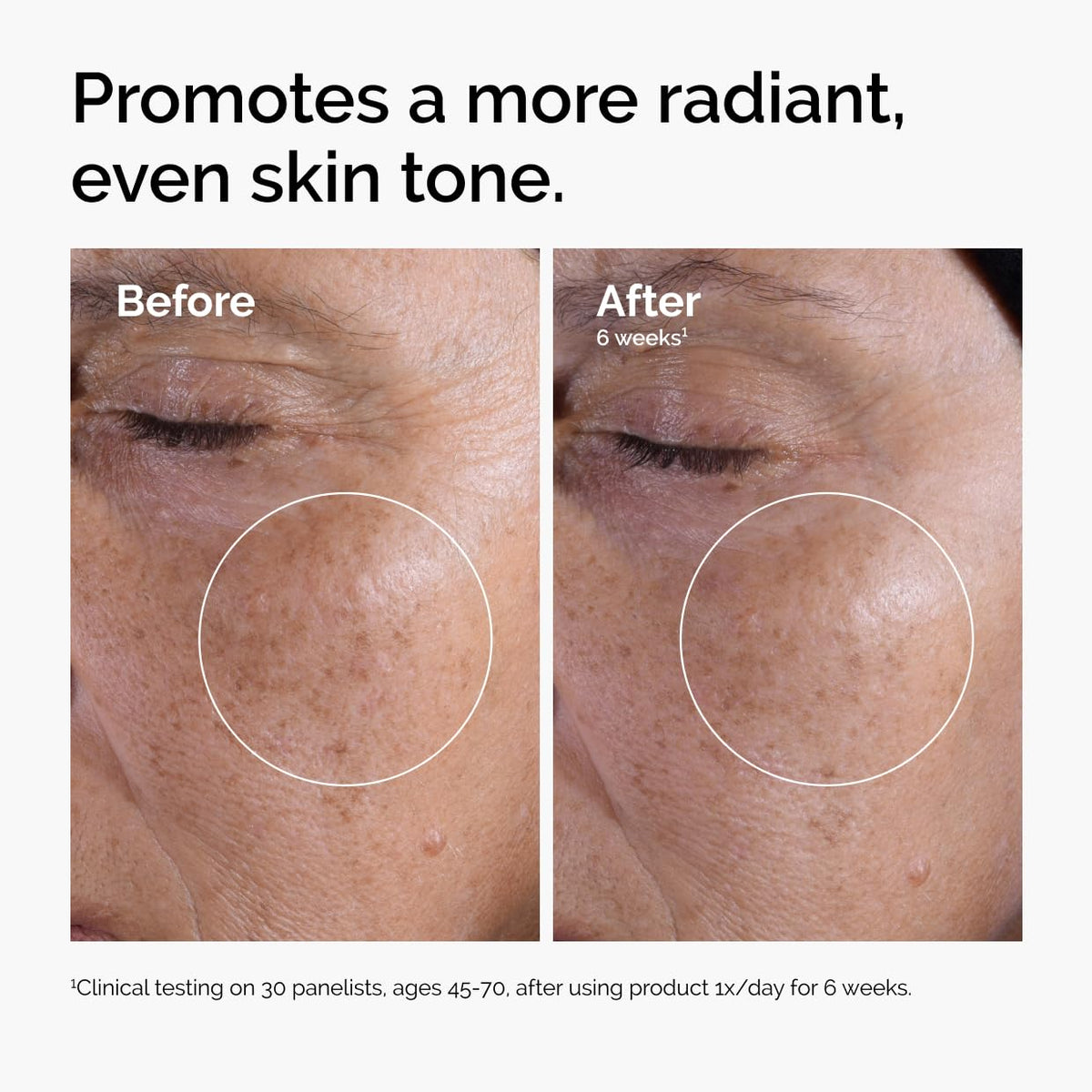 The Ordinary Tónico Exfoliante 7% Ácido Glicólico Tamaño: 3,4 fl oz (paquete de 1)
