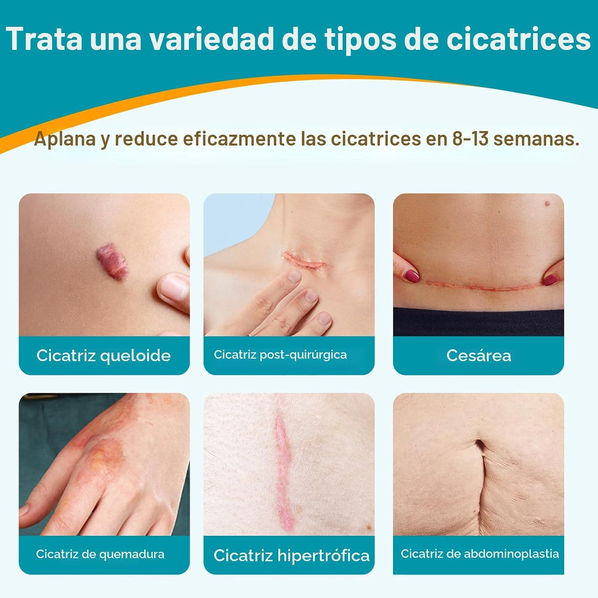 Dimora UPF50+ - Hojas de silicona para cicatrices, rollo de 1.6"...