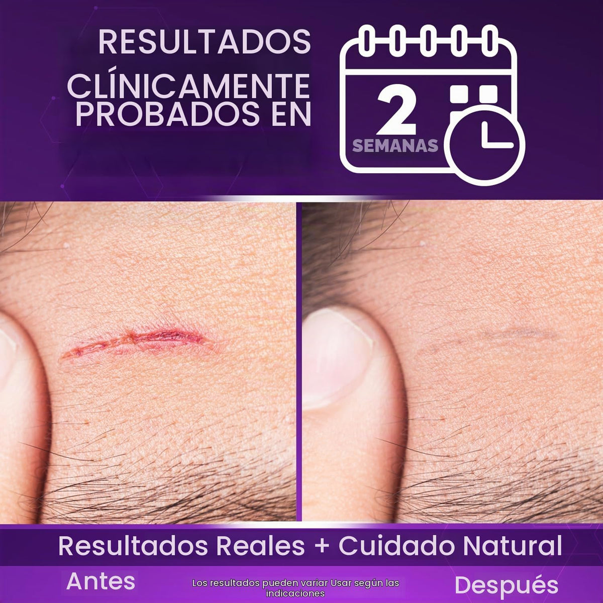 Cicatricure Advanced Scar Gel, resultados comprobados en 2 semanas,...