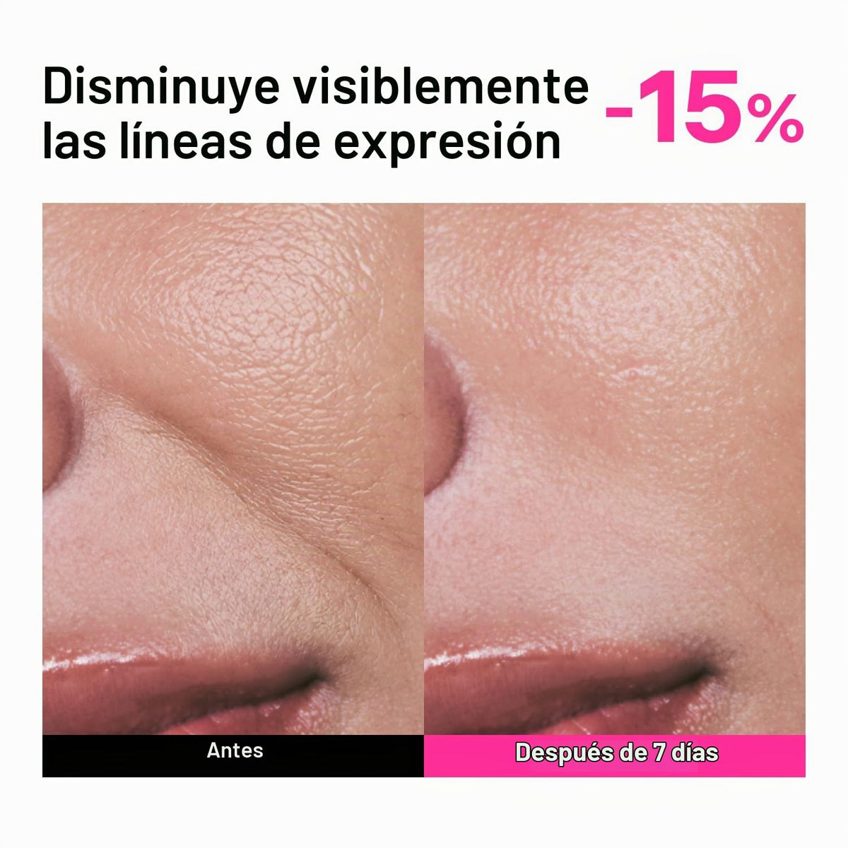 Colágeno, péptido y suero retiniano para líneas finas y arrugas (pa...