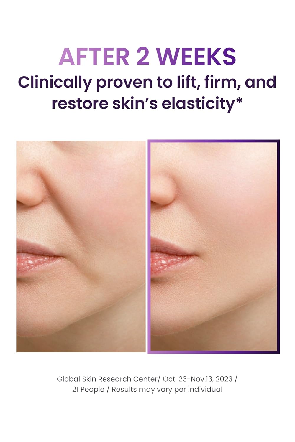 BIOHEAL BOH Probioderm 3D Lifting - Kit de cuidado de la piel de ta...