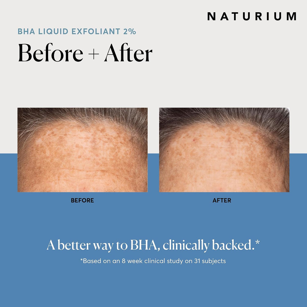 Naturium BHA - Exfoliante líquido al 2%, tratamiento exfoliante de...