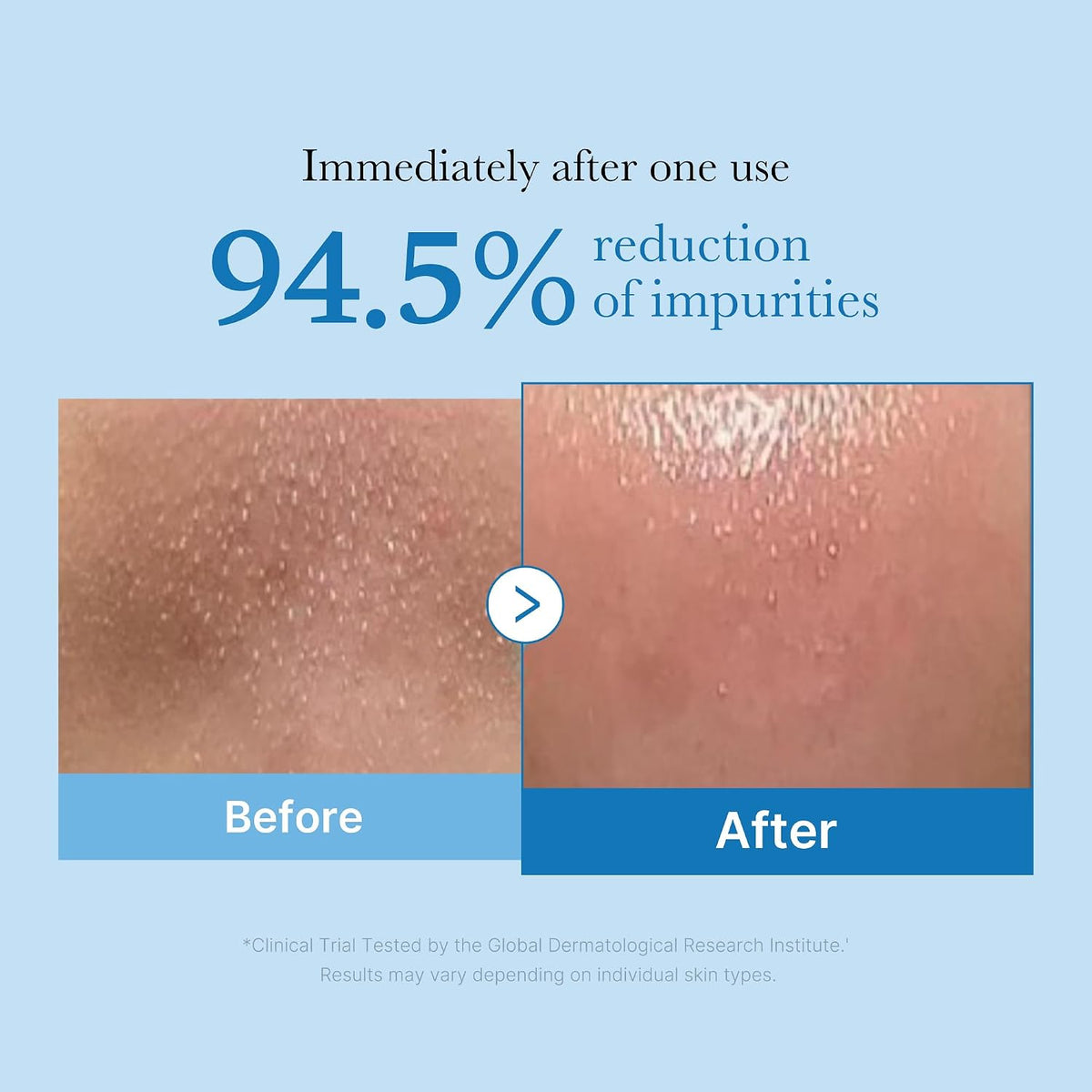 medicube Aceite limpiador cero poros, removedor de maquillaje, espi...
