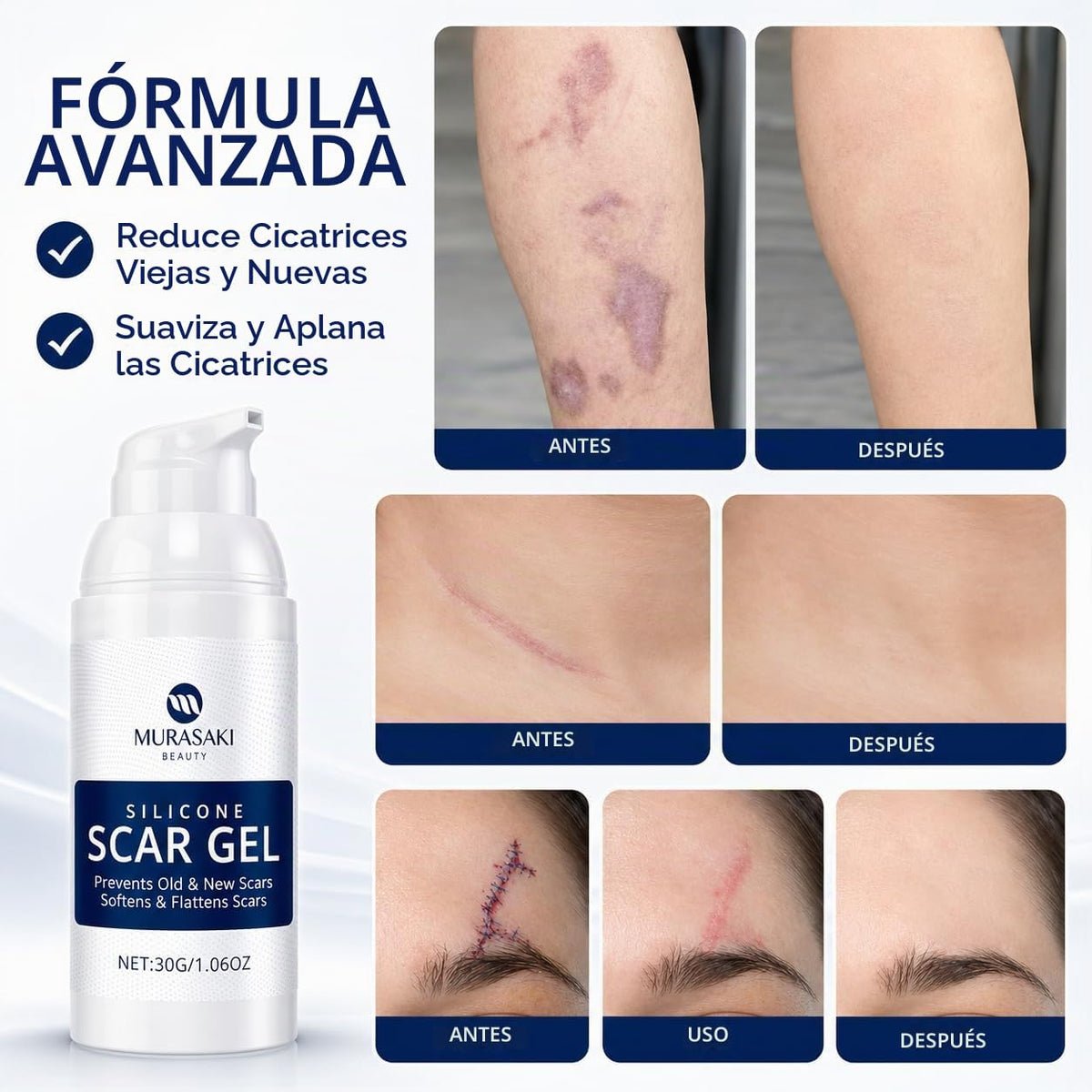 Gel de cicatriz 100% silicona crema para cicatrices \u2013 Gel avan...