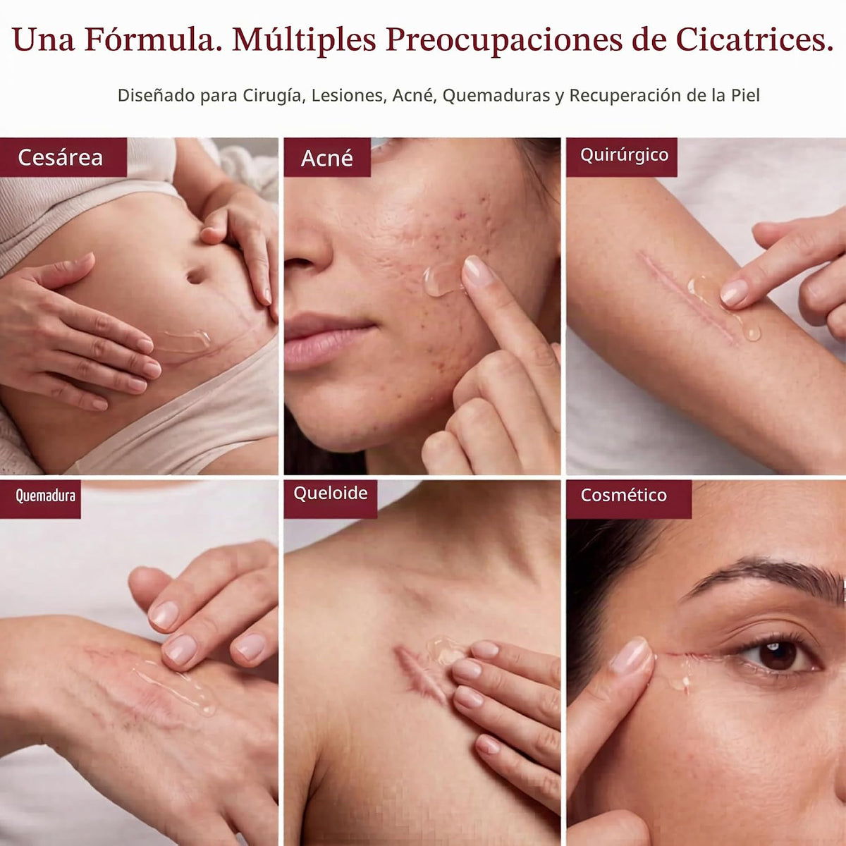 HealFast Gel de silicona para cicatrices, crema para cicatrices qui...