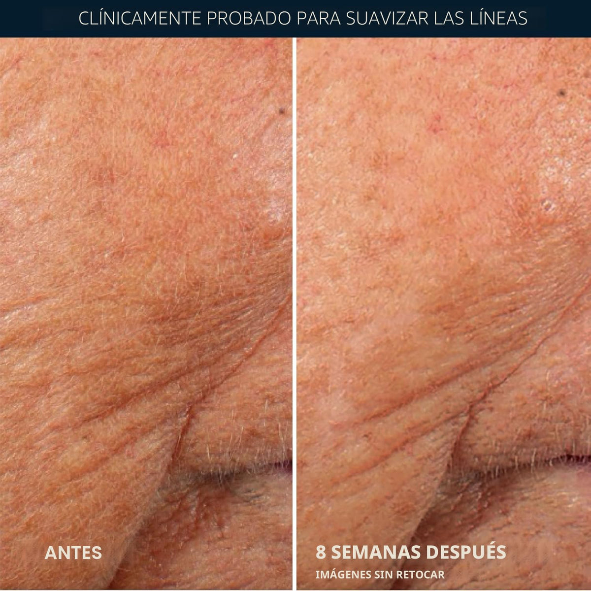 RoC Retinol Correxion Cápsulas de suero nocturno antienvejecimiento...