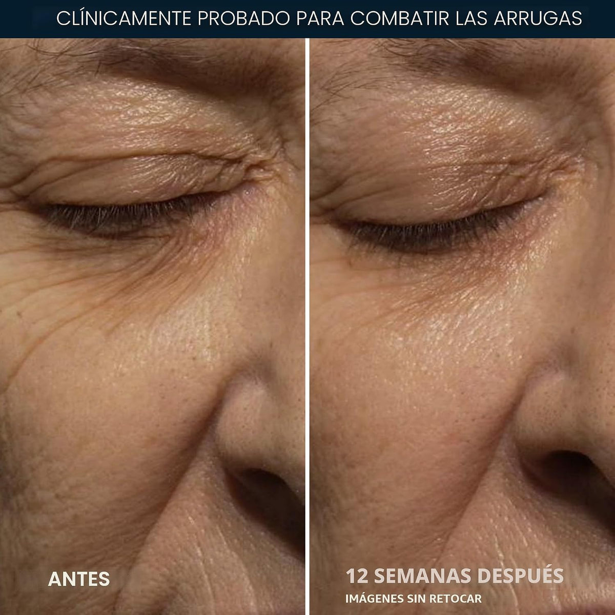 RoC Retinol Correxion Deep Wrinkle Crema de noche antienvejecimient...