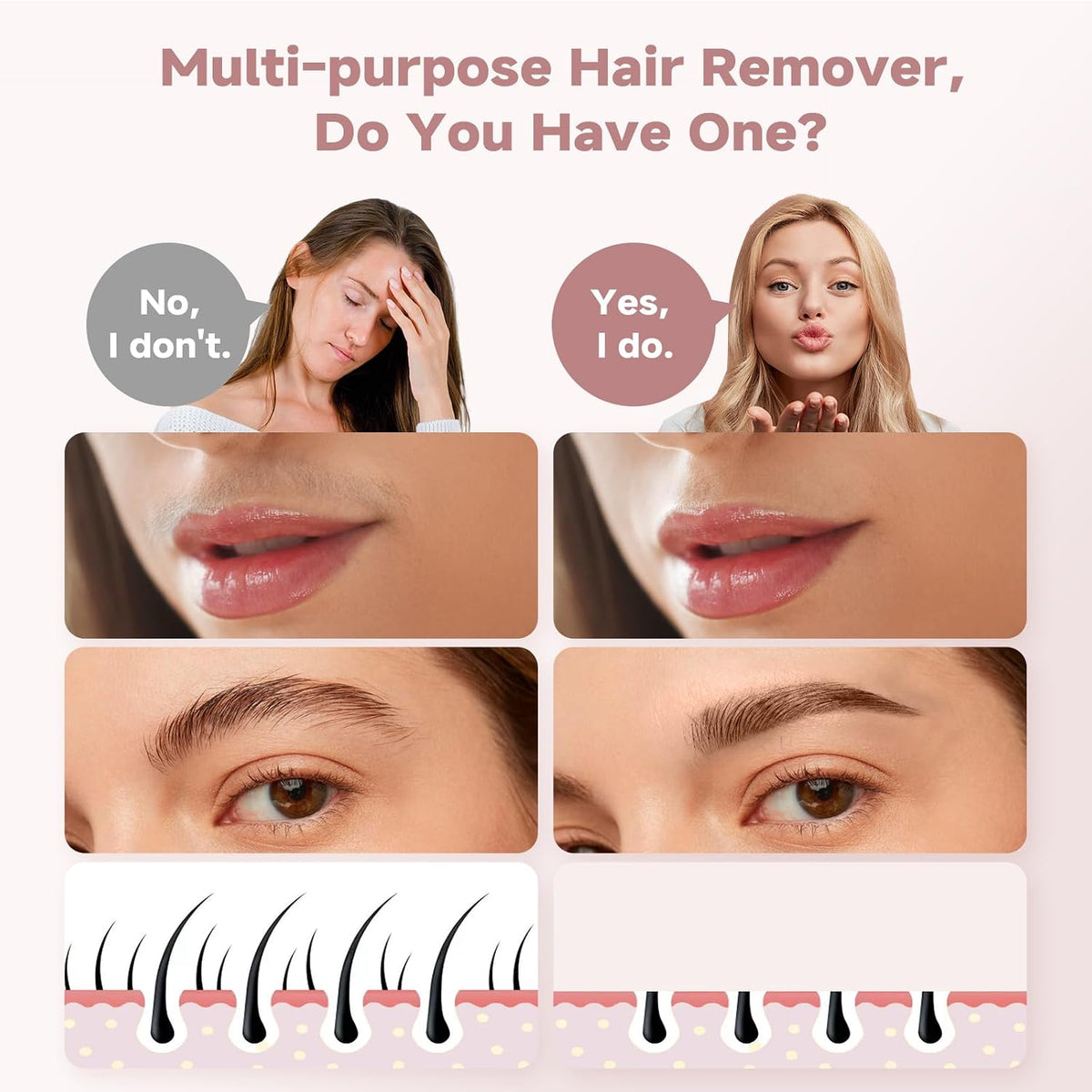 Removedor de vello facial para mujeres (Gen 3 Pro), recortador faci...