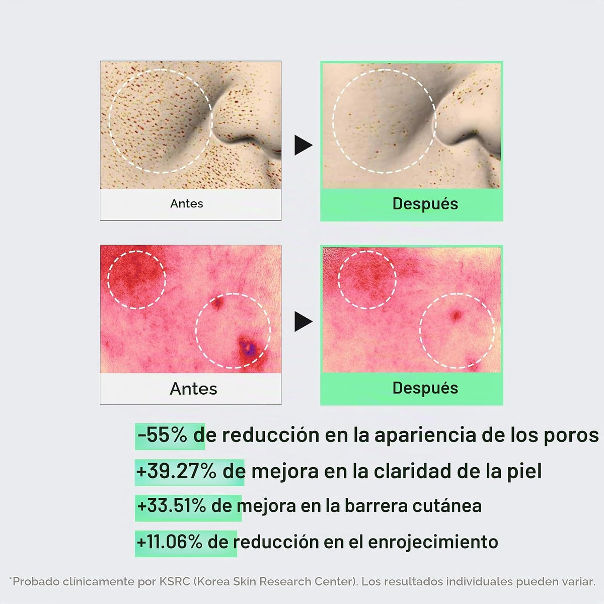 VT COSMETICS CICA Reedle Shot 100 Suero de microagujas | Espícula,...