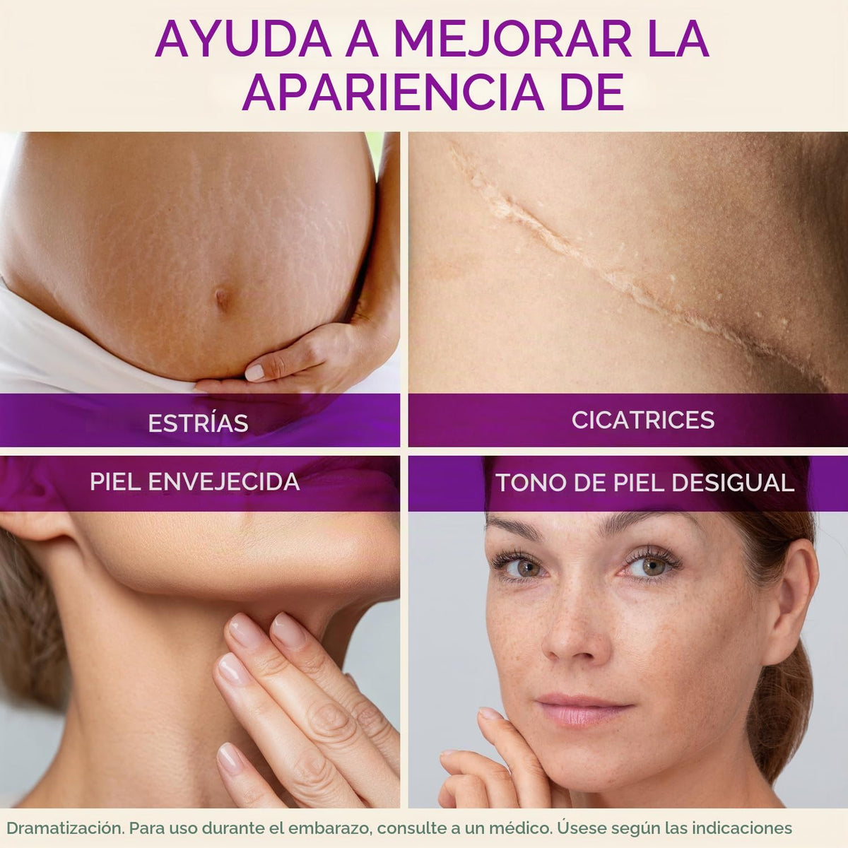 Cicatricure Aceite de cica para estrías y cicatrices, aceite corpor...