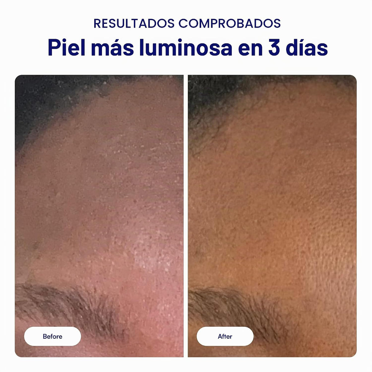 Bliss That's Incredi-Peel - Almohadillas faciales renovadoras c...