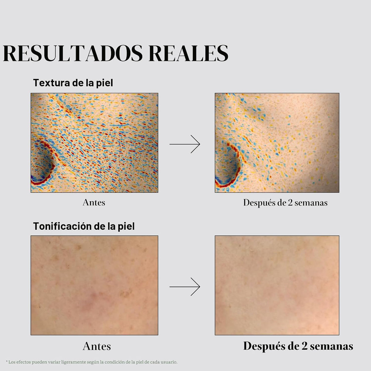 VT COSMETICS TX Mascarilla Tonificante Diaria 30 Hojas, Ácido Trane...
