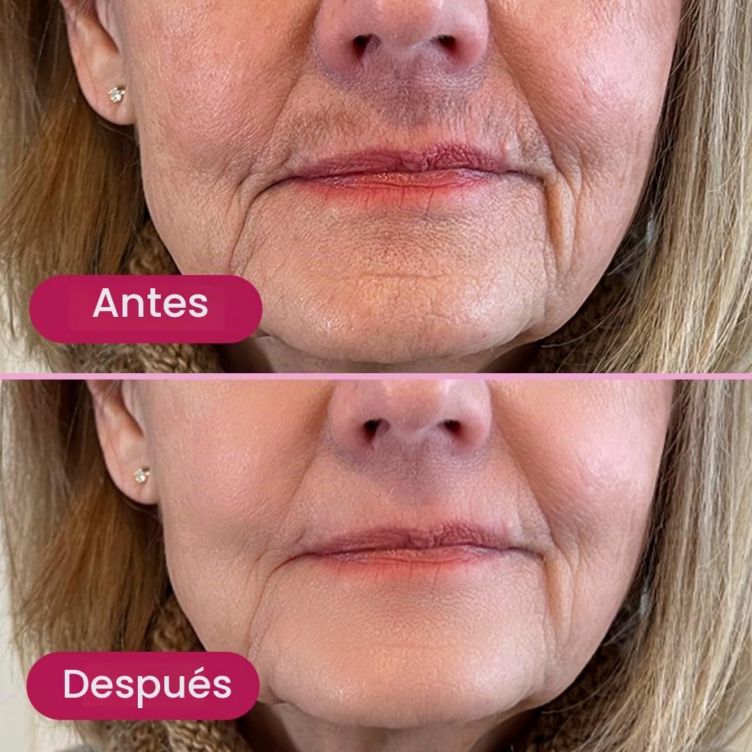 Glabrouse Depiladora de piel, removedor de vello Glabrous Skin para...
