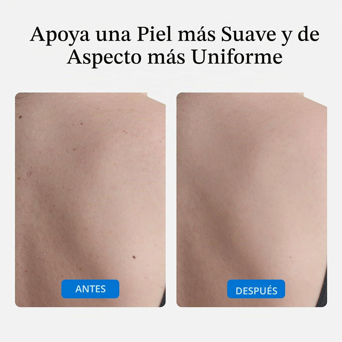 NUVADERMIS Aceite corporal restaurador para cicatrices, estrías y p...