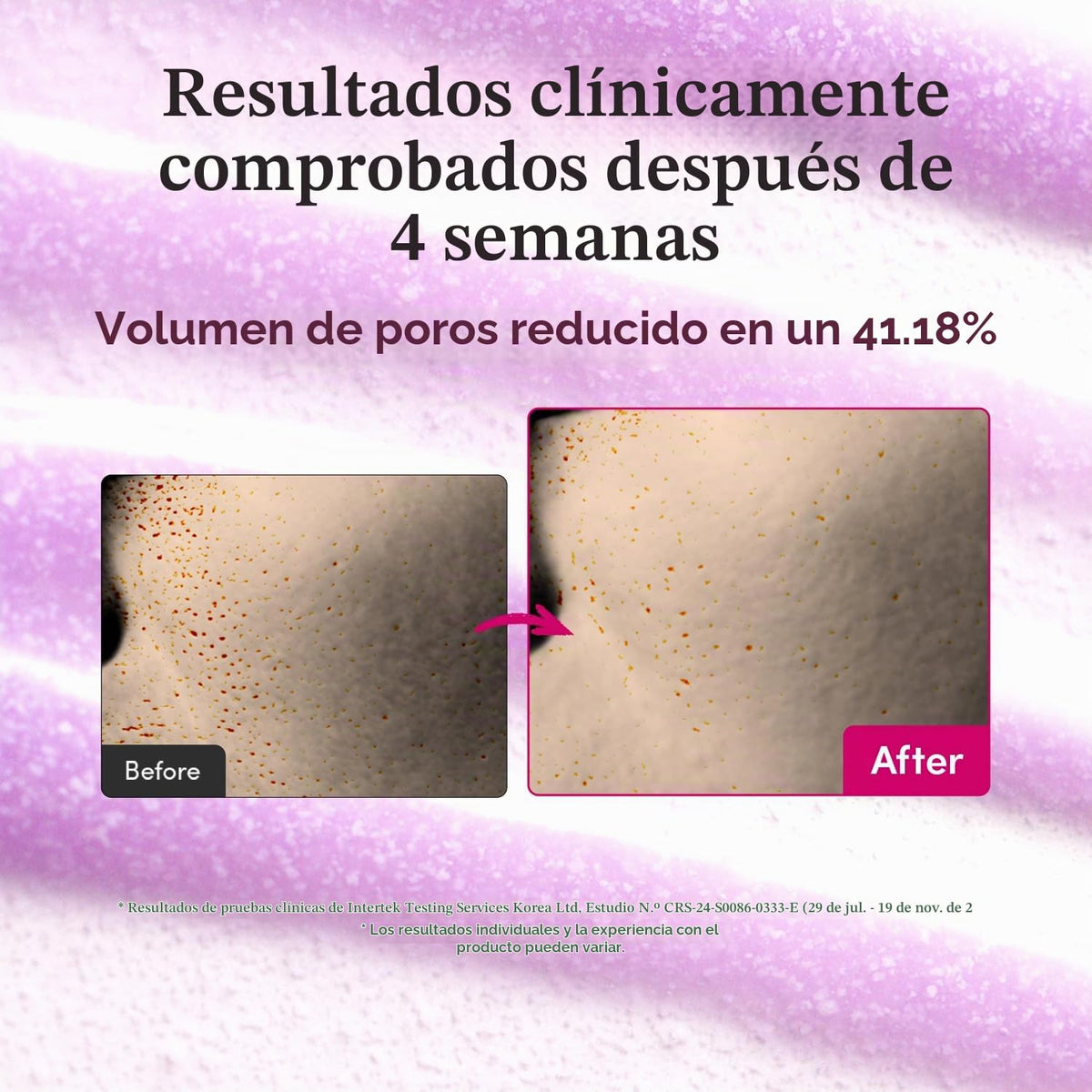 EQQUALBERRY Bakuchiol - Suero rellenador | Alternativa de retinol B...