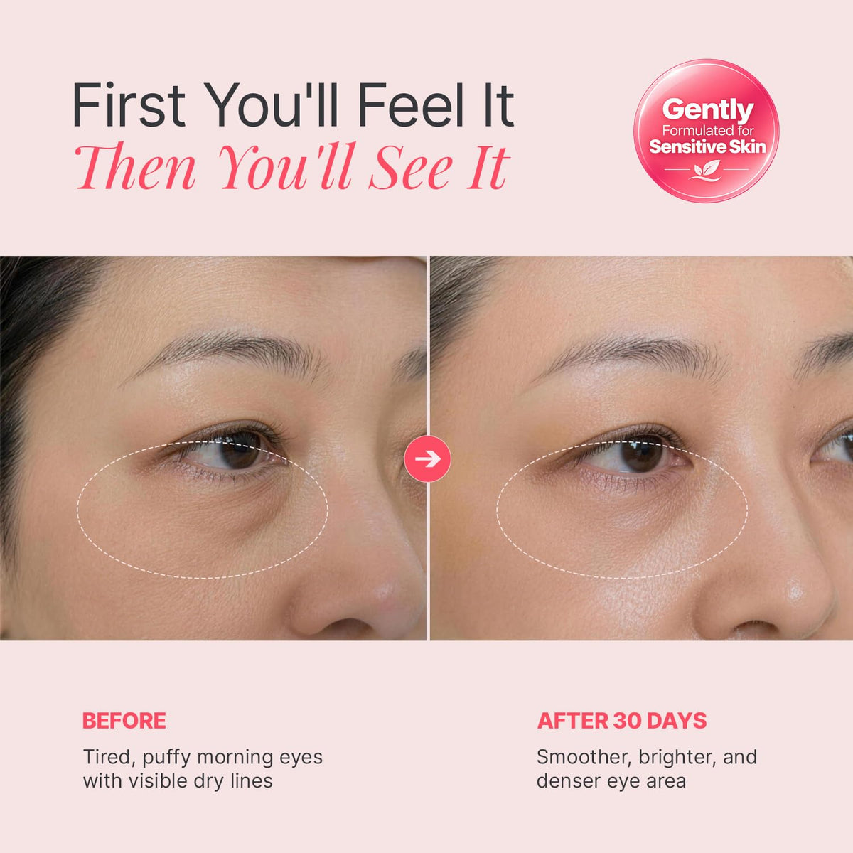 ENASKIN NATURALS PDRN &amp; NAD+ Crema de ojos antienvejecimiento c...