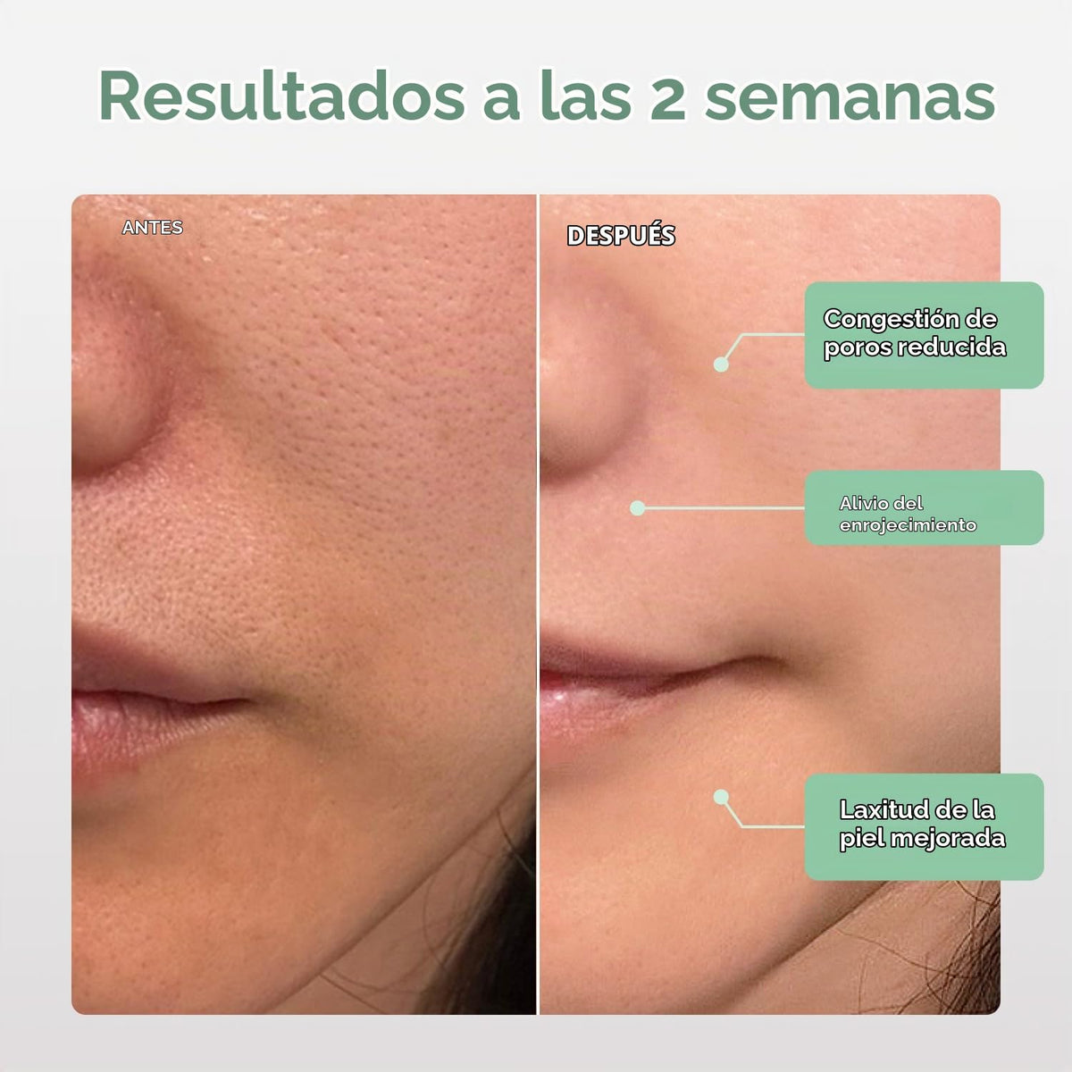 Nanoleaf Máscara facial de terapia de luz LED aprobada por la FDA c...