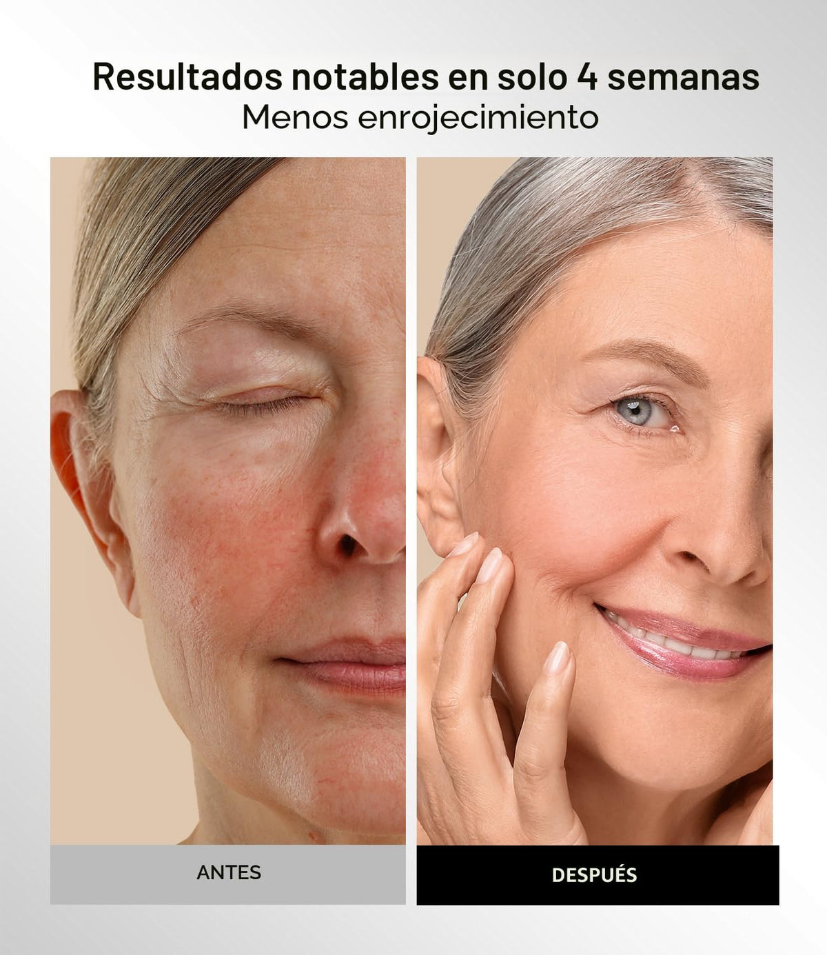 Máscara de terapia de luz roja INIA para rostro, cuello y pecho, NI...