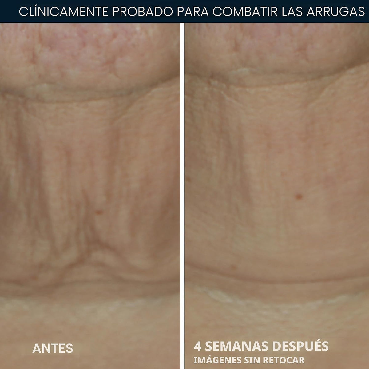 RoC Derm Correxion Retinol suero reafirmante en barra con antioxida...
