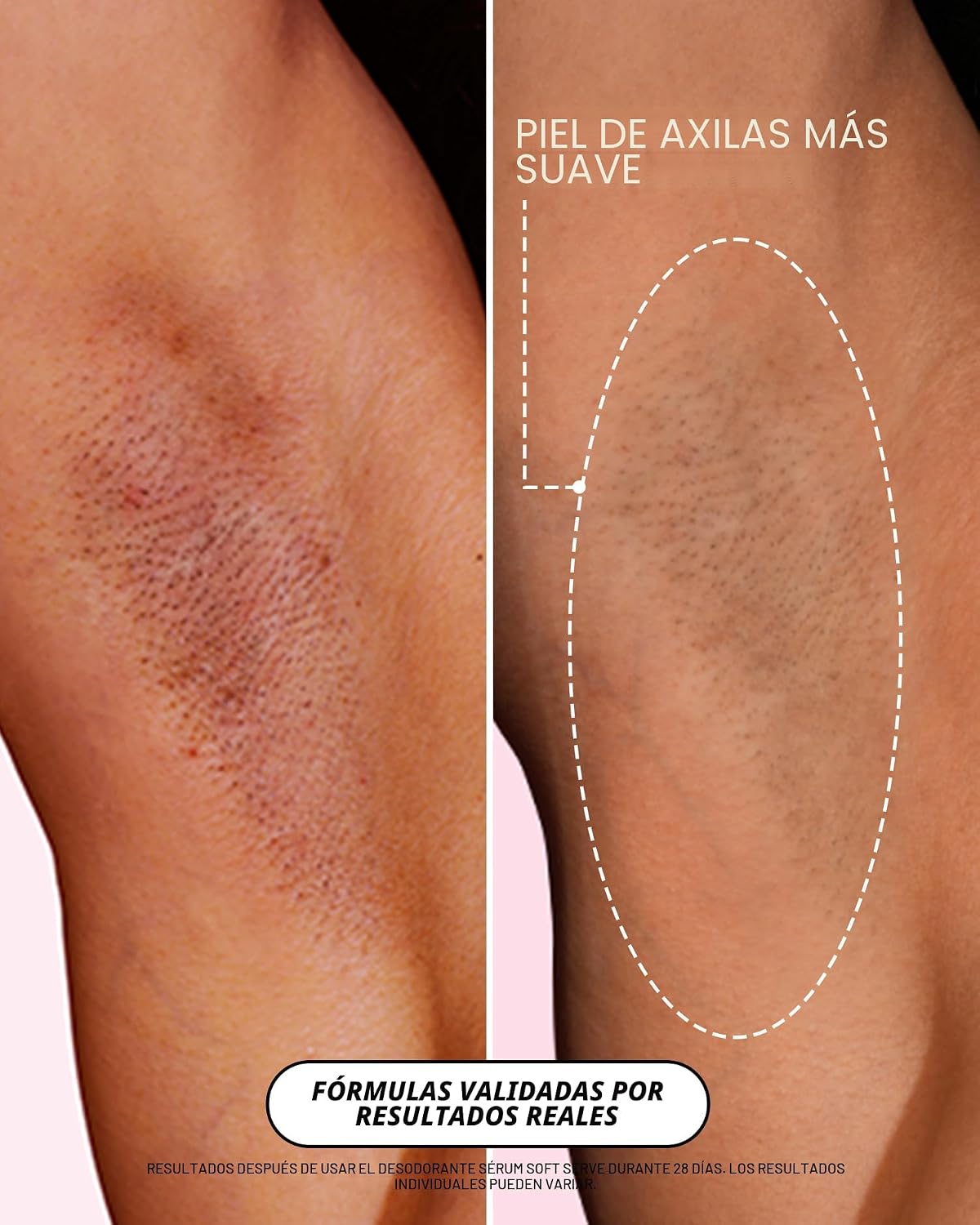 Truly Desodorante de suero Beauty Soft Serve | Desodorante AHA sin...