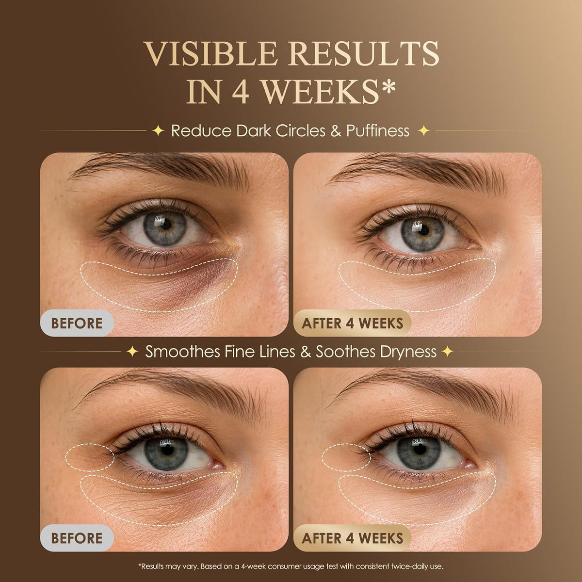 Suero debajo de los ojos para ojeras e hinchazón: suero de ojos con...