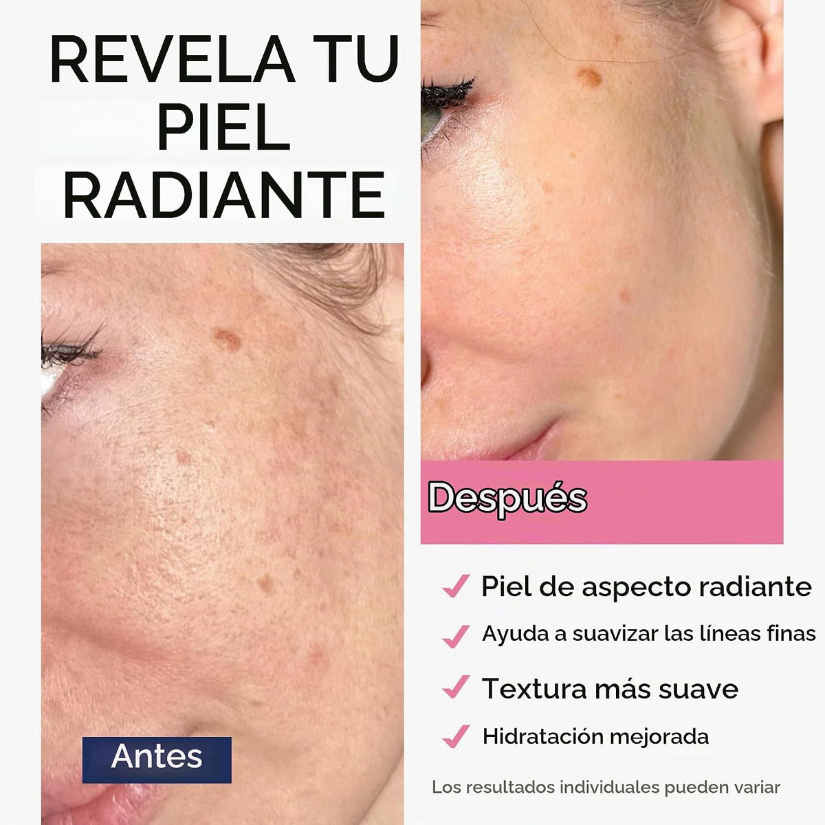 Ember Cloud - Suero de retinol para rostro con ácido hialurónico y...