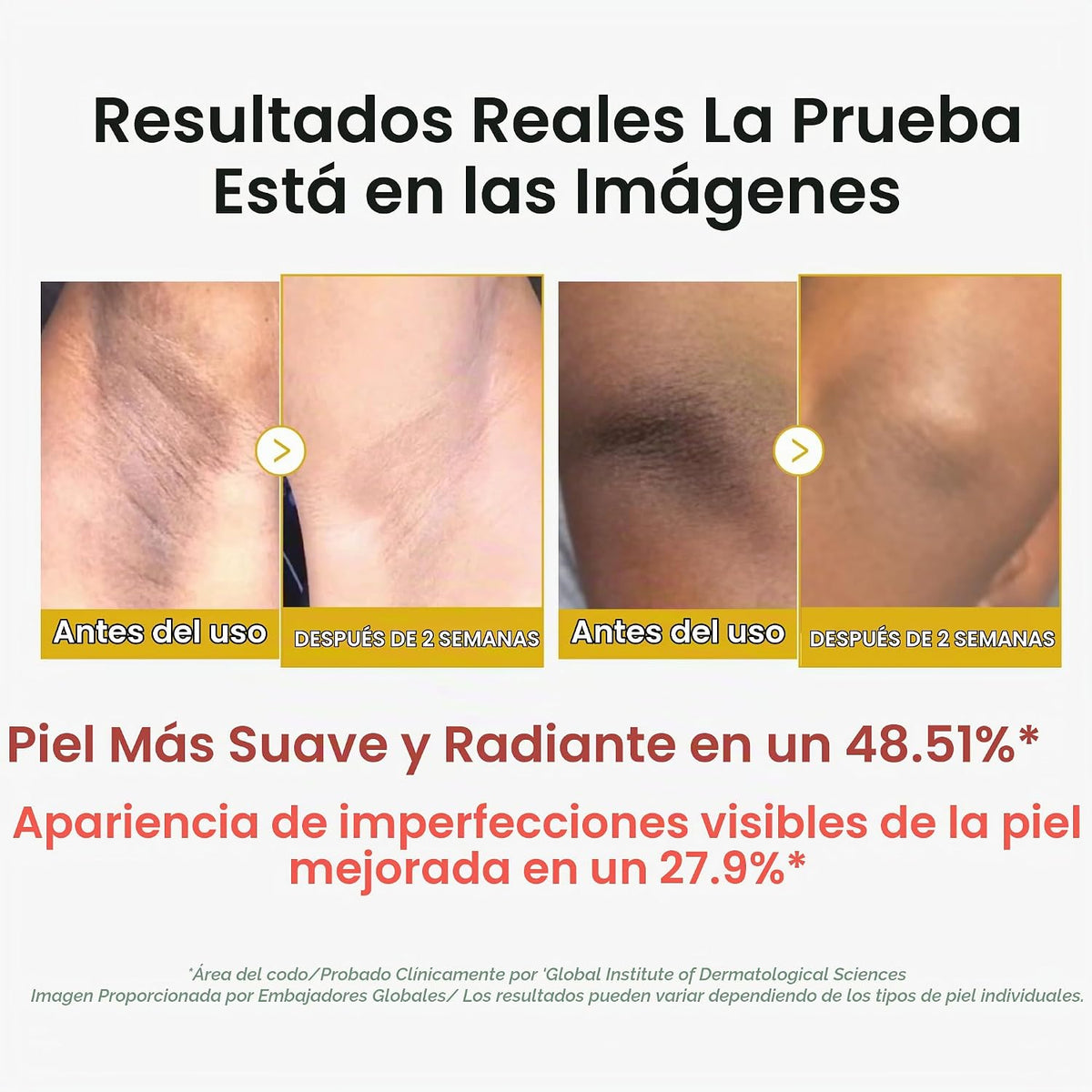 medicube Body Peel Shot Duo - Disparo corporal con ácido hipocloros...