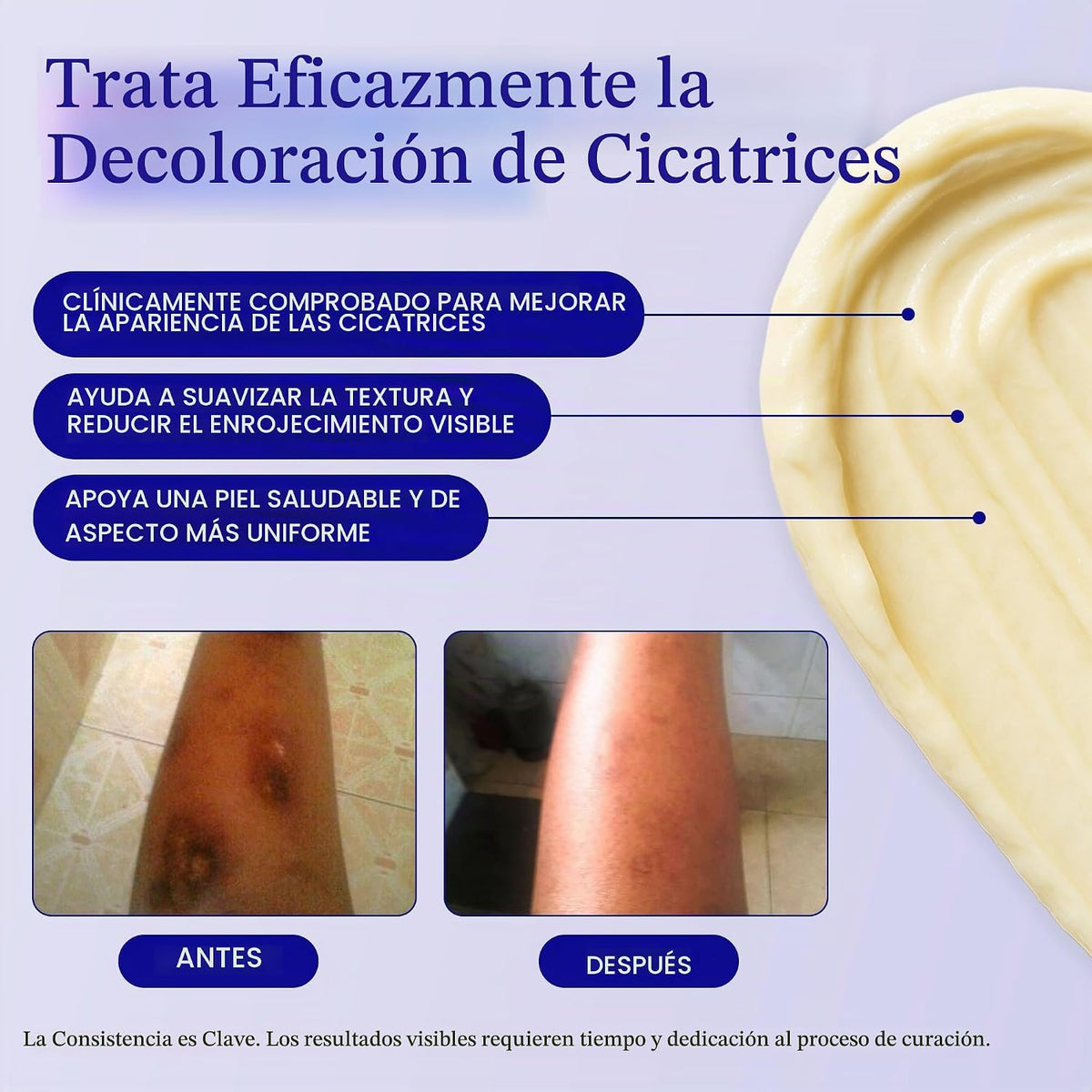 Rejuvaskin Esthetique Crema para cicatrices con silicona, 23 ingred...
