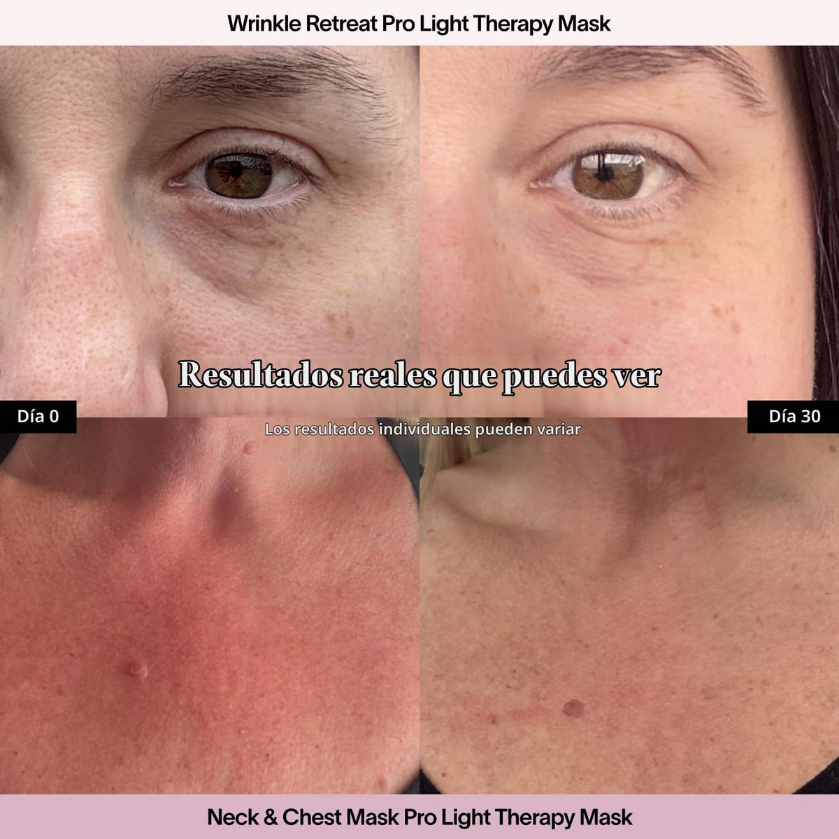 Solawave Máscara facial de terapia de luz y máscara de cuello y pec...
