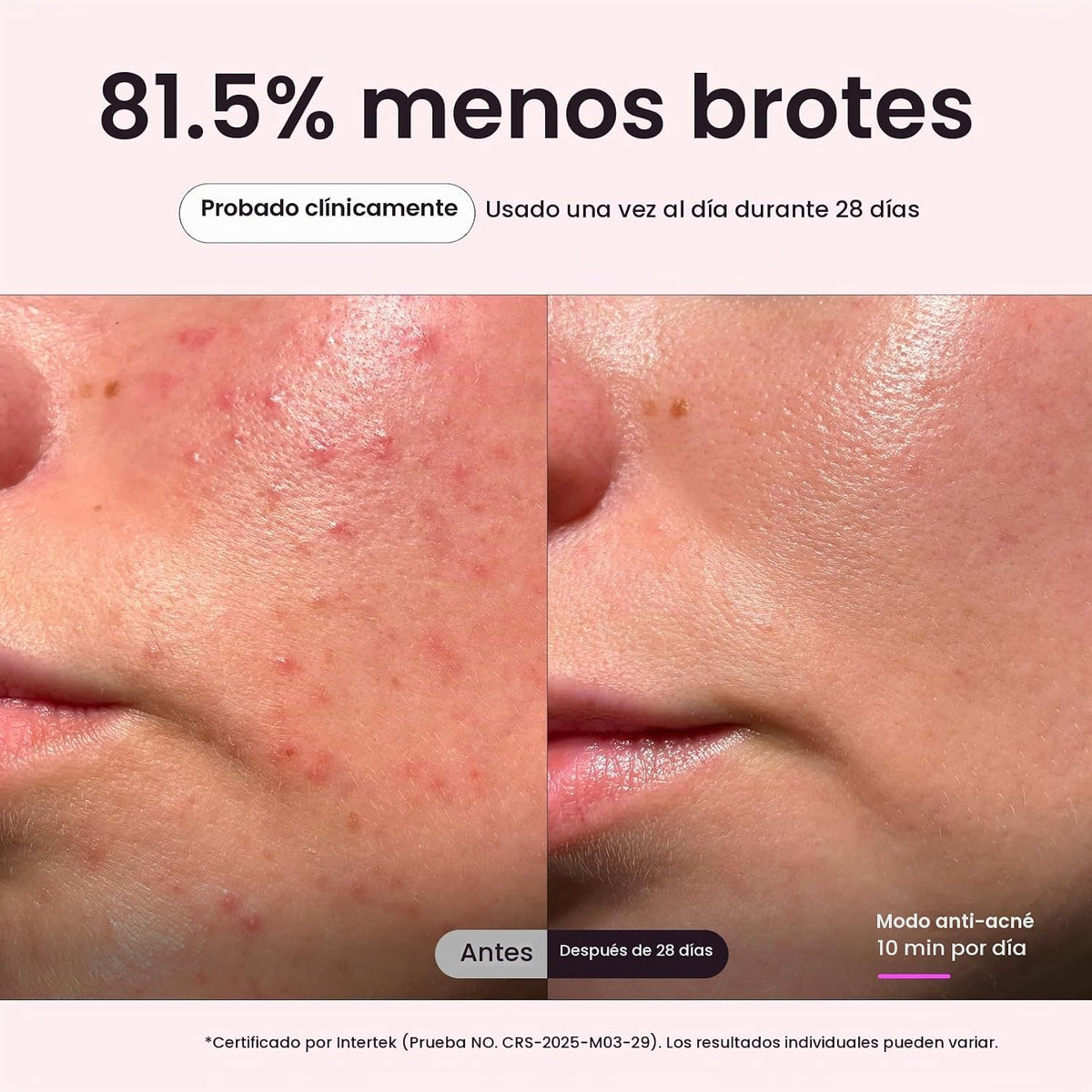 Wavytalk Máscara de terapia de luz roja para cara, ELLE mejor herra...