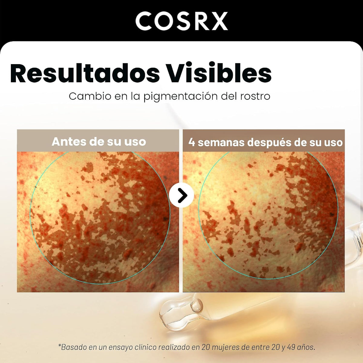 COSRX Suero para el cuidado de la decoloración de alfa arbutina al...