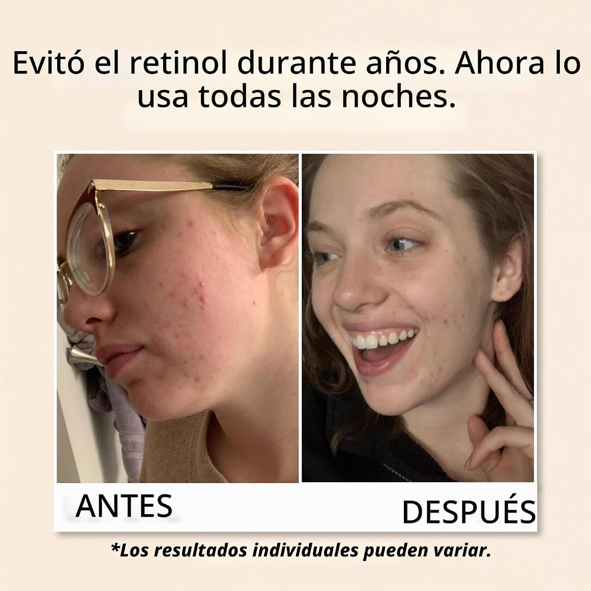 YEOUTH Suero de retinol para rostro con ácido hialurónico y vitamin...
