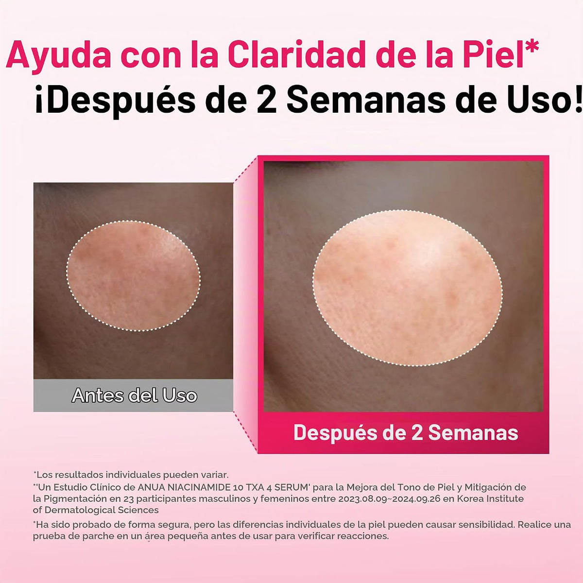 Anua Dúo corrector de manchas | Niacinamide 10 + TXA 4 Serum &amp;...