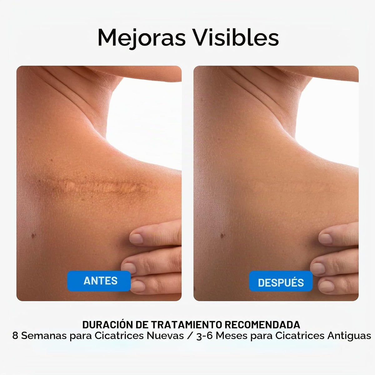 NUVADERMIS Gel de cicatrices para cicatrices quirúrgicas y cicatric...