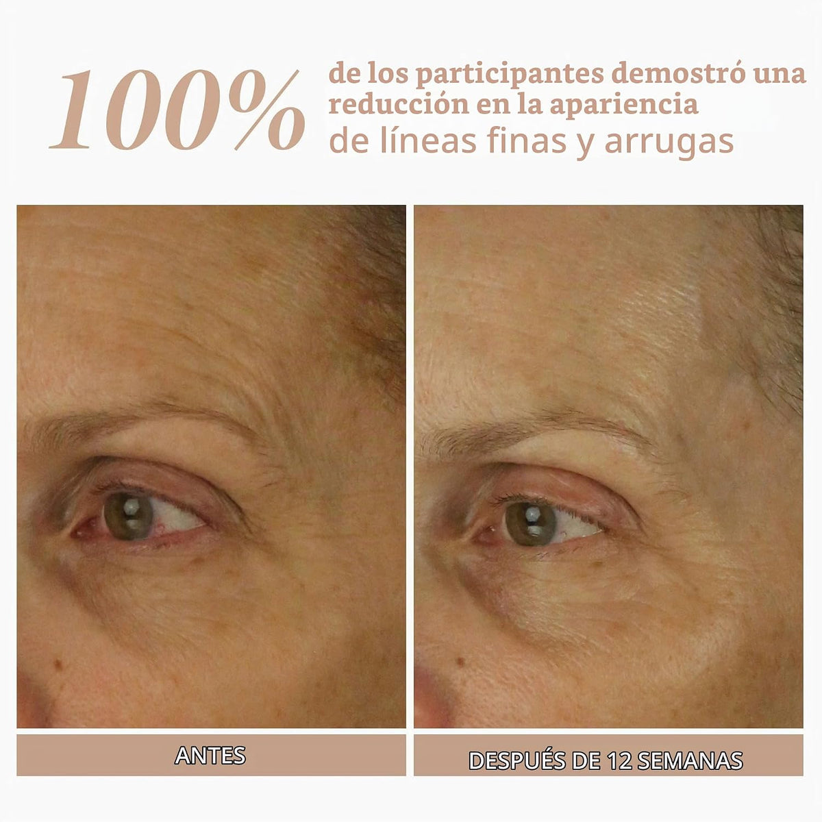 Shani Darden Skincare Retinol Reform con suero de retinol encapsula...