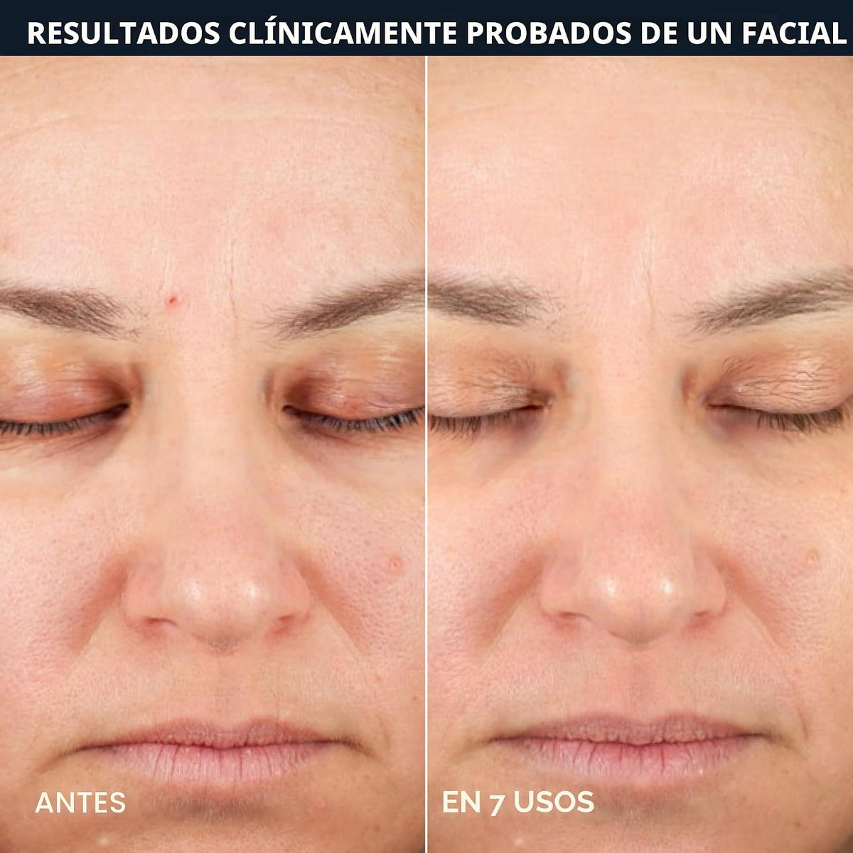 RoC Retinol Correxion Line Smoothing Almohadillas de 2 Pasos - 5 |...