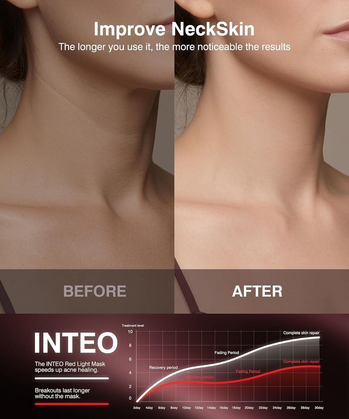 Máscara de terapia de luz roja para cara y cuello, NIR de 850 nm y...