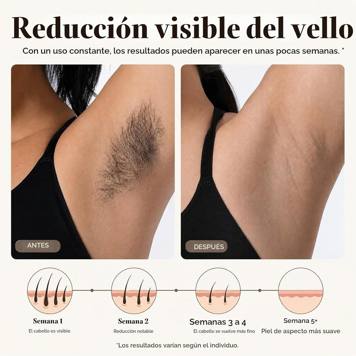 MITHLUX - Dispositivo de depilación láser para mujeres, enfriamient...